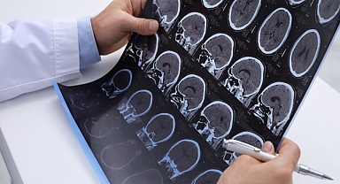 Alzheimer ile ilgili erken şikayetler