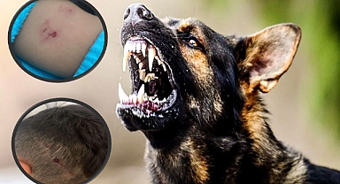 Şanlıurfa’da Başıboş Köpeklerin Saldırısı: Bir Öğrenci Hastaneye Kaldırıldı