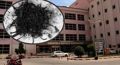 Zihinsel Engelli Bireyin Midesinden Çivi ve Toka Çıktı!