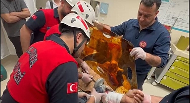 Şanlıurfa'da Koluna İnşaat Demiri Saplanan Vatandaş Kurtarıldı