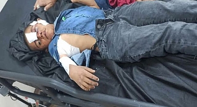 Şanlıurfalı Mahmut, Konya'da Başıboş Köpeklerin Hedefi Oldu!