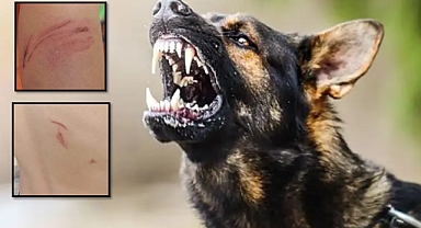 Şanlıurfa Hilvan’da Köpek Dehşeti! Küçük Çocuğu Isırdı