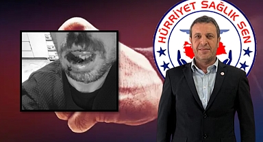 Başkan Bekir Baran: ‘Saldırganın Serbest Bırakılması Kabul Edilemez!’