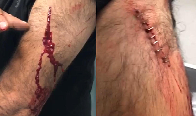 Şanlıurfa'da Feci Olay, Para İstemeye Karşı Çıkan Öğretmene Jiletli Saldırı!