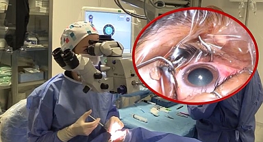 Uz. Dr. Öznur Aday Uyardı! Katarakt Erken Teşhis ile Tedavi Ediliyor