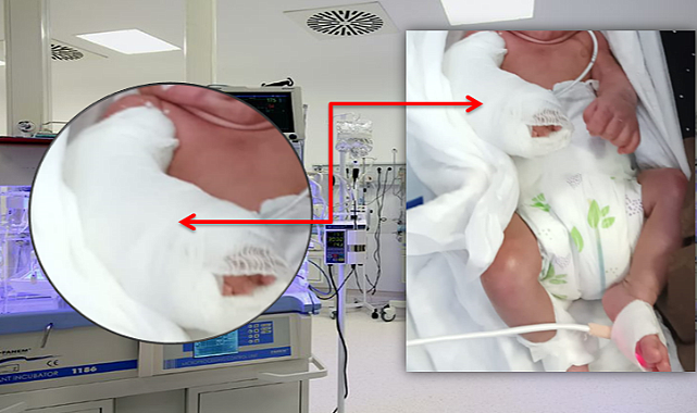 Şanlıurfa’da Sağlık Skandalı! Bebeğin Kolunu Kırdılar Ailesi Fark Etti