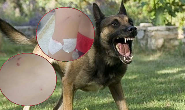 Şanlıurfa Viranşehir’de 6 Yaşındaki Kıza Köpek Saldırısı!